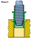 Time Sert Thread Repair Kit M10X1.25