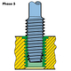 Time Sert Thread Repair Kit M10X1.25